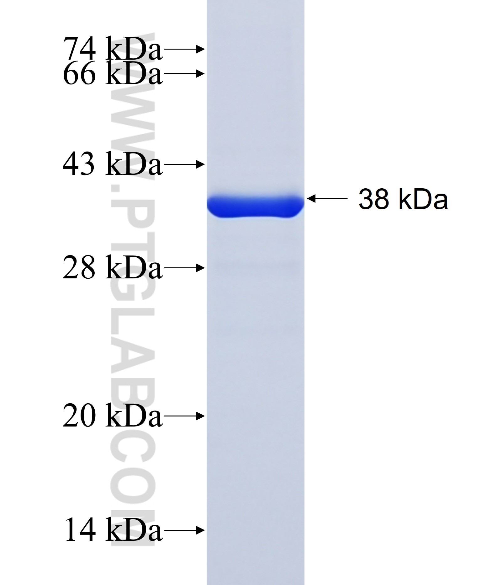 HOXC11 fusion protein Ag40578 SDS-PAGE HOXC11 fusion protein Ag40578 SDS-PAGE