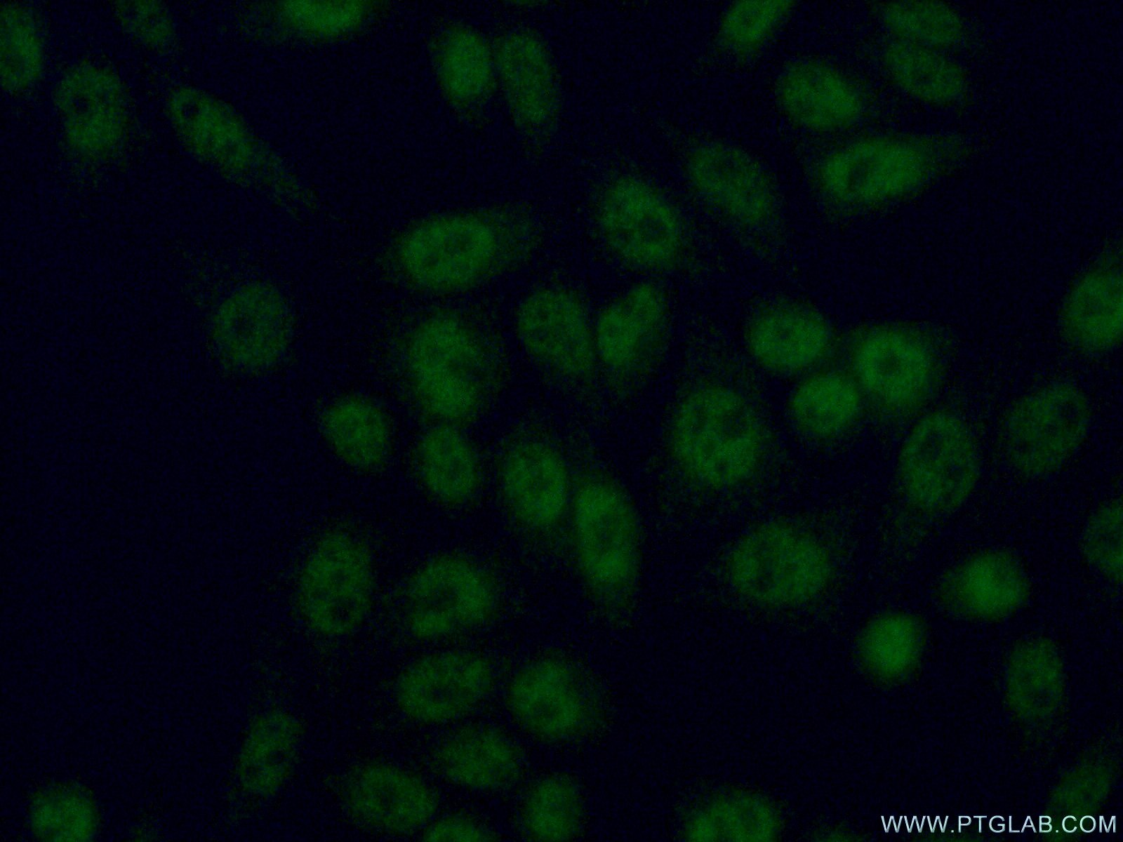 Immunofluorescence (IF) / fluorescent staining of HeLa cells using HOXC4 Polyclonal antibody (14321-1-AP)