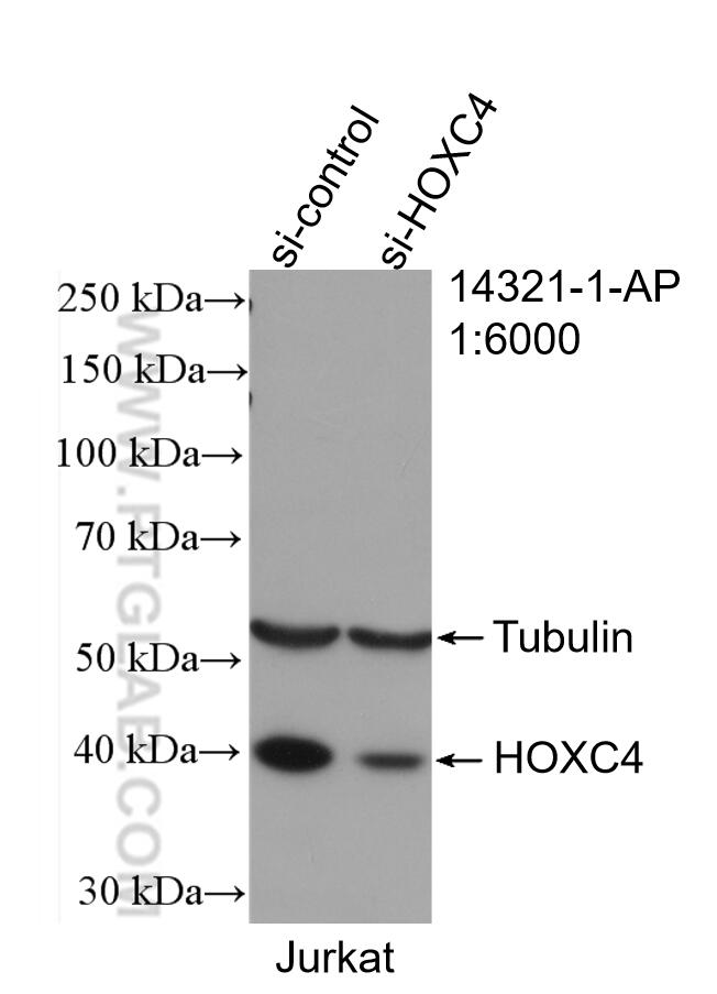 Western Blot (WB) analysis of Jurkat cells using HOXC4 Polyclonal antibody (14321-1-AP)