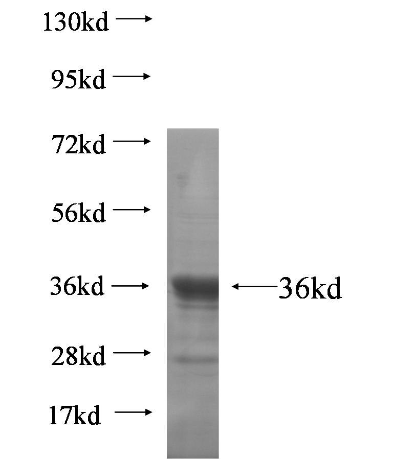 HOXC4 fusion protein Ag5548 SDS-PAGE