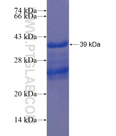 HOXC6 fusion protein Ag20303 SDS-PAGE HOXC6 fusion protein Ag20303 SDS-PAGE