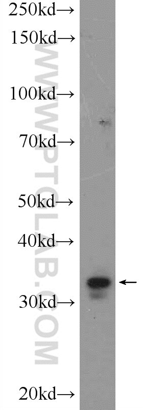 Western Blot (WB) analysis of COLO 320 cells using HOXC8 Polyclonal antibody (15448-1-AP)