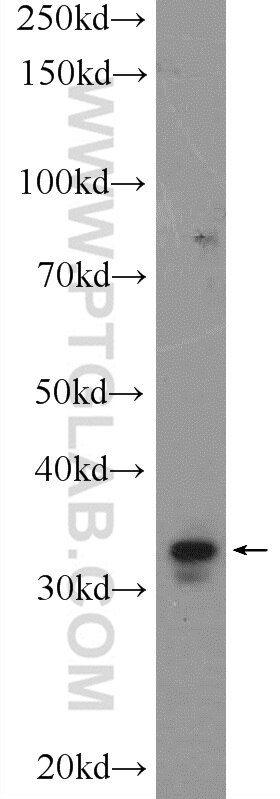 WB analysis of COLO 320 using 15448-1-AP