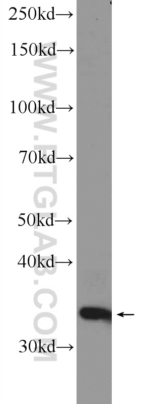 Western Blot (WB) analysis of MDA-MB-453s cells using HOXC8 Polyclonal antibody (15448-1-AP)