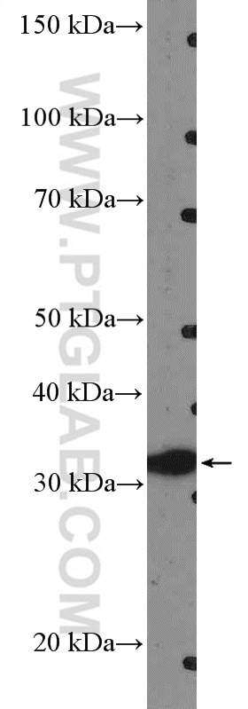 Western Blot (WB) analysis of COLO 320 cells using HOXC8 Polyclonal antibody (15448-1-AP)