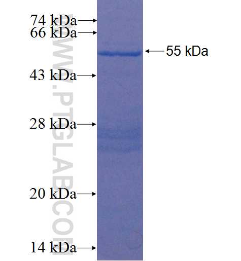 HOXC9 fusion protein Ag22527 SDS-PAGE HOXC9 fusion protein Ag22527 SDS-PAGE