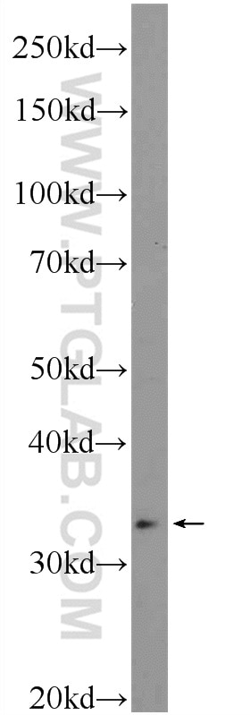 Western Blot (WB) analysis of SMMC-7721 cells using HOXD11 Polyclonal antibody (18734-1-AP)