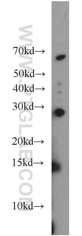 Western Blot (WB) analysis of mouse liver tissue using HOXD12 Polyclonal antibody (18735-1-AP)