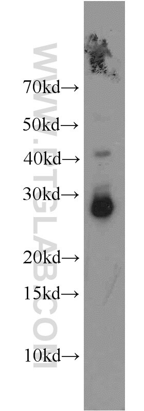 Western Blot (WB) analysis of mouse skeletal muscle tissue using HOXD12 Polyclonal antibody (18735-1-AP)