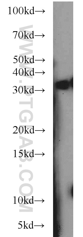 Western Blot (WB) analysis of L02 cells using HOXD12 Polyclonal antibody (18735-1-AP)