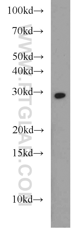 Western Blot (WB) analysis of mouse liver tissue using HOXD12 Polyclonal antibody (18735-1-AP)