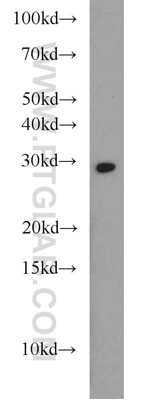 WB analysis of mouse liver using 18735-1-AP