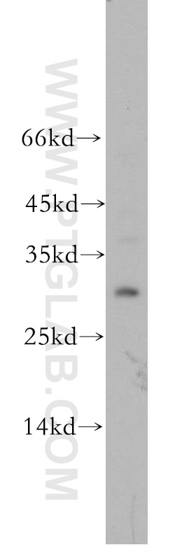 Western Blot (WB) analysis of mouse liver tissue using HOXD12 Polyclonal antibody (18735-1-AP)