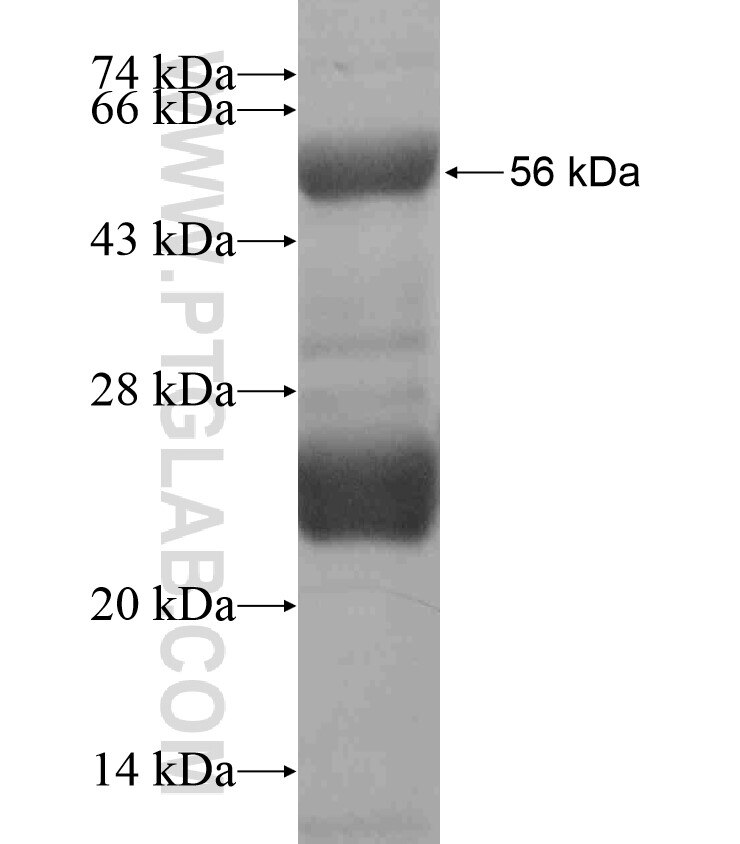 HOXD12 fusion protein Ag18577 SDS-PAGE
