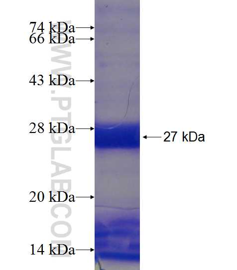 HOXD12 fusion protein Ag18675 SDS-PAGE