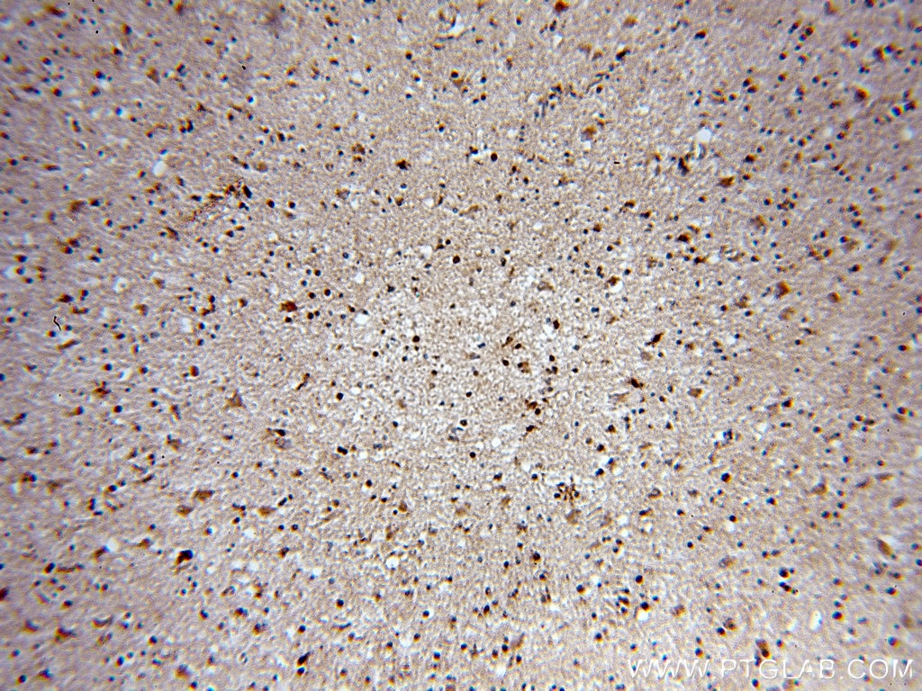 Immunohistochemistry (IHC) staining of human brain tissue using HOXD13 Polyclonal antibody (18736-1-AP)