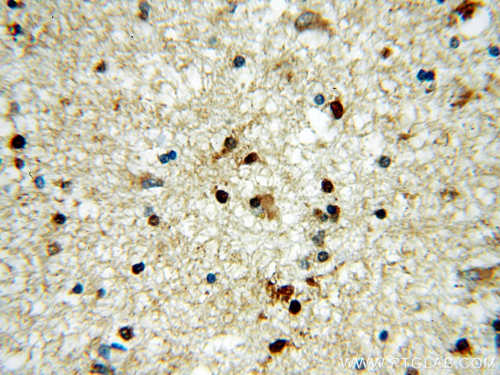 Immunohistochemistry (IHC) staining of human brain tissue using HOXD13 Polyclonal antibody (18736-1-AP)