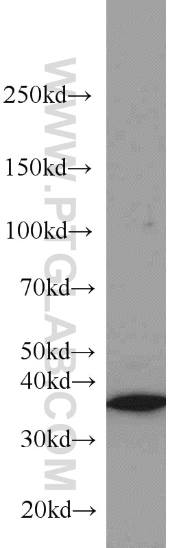 Western Blot (WB) analysis of A549 cells using HOXD13 Polyclonal antibody (18736-1-AP)