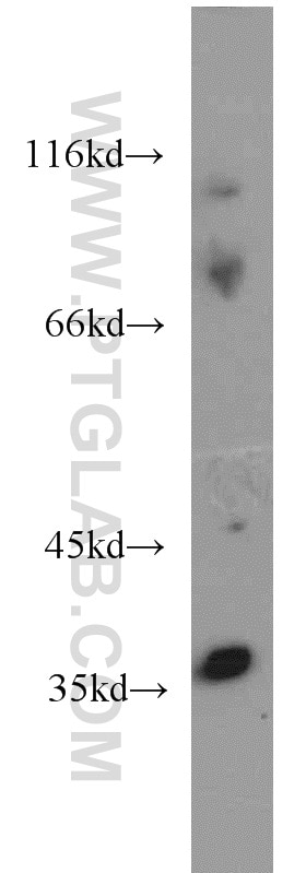 Western Blot (WB) analysis of mouse lung tissue using HOXD13 Polyclonal antibody (18736-1-AP)