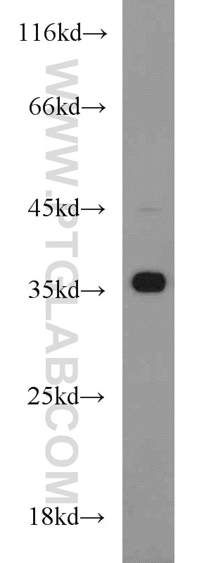 Western Blot (WB) analysis of mouse brain tissue using HOXD13 Polyclonal antibody (18736-1-AP)