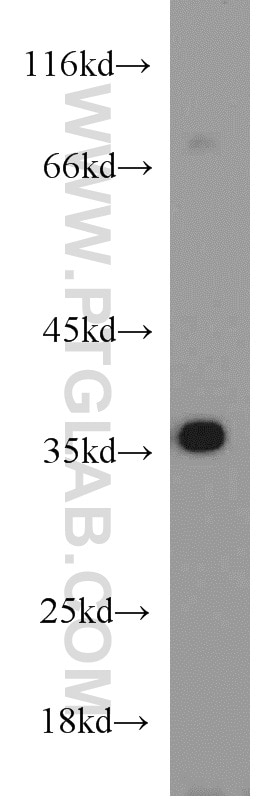 Western Blot (WB) analysis of Jurkat cells using HOXD13 Polyclonal antibody (18736-1-AP)