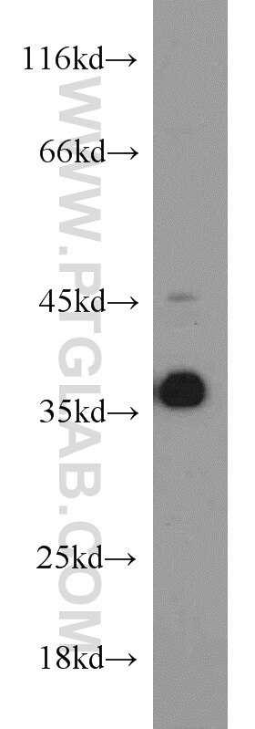 Western Blot (WB) analysis of rat brain tissue using HOXD13 Polyclonal antibody (18736-1-AP)