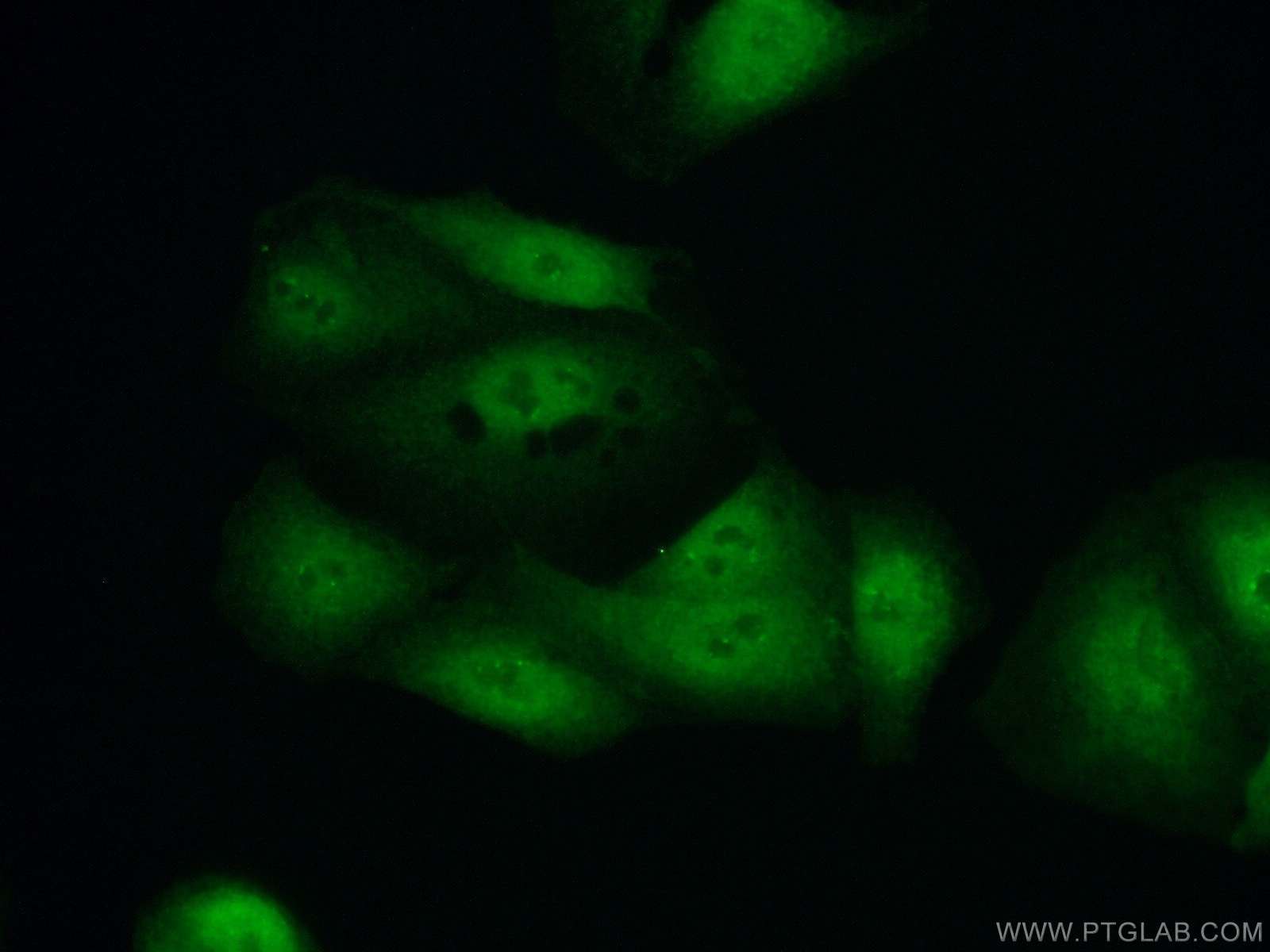 Immunofluorescence (IF) / fluorescent staining of A549 cells using HOXD13 Polyclonal antibody (23520-1-AP)