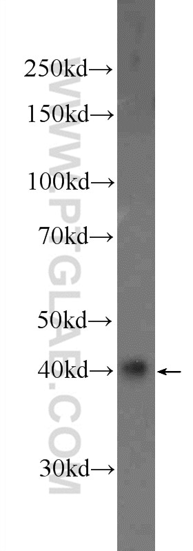 Western Blot (WB) analysis of A549 cells using HOXD13 Polyclonal antibody (23520-1-AP)
