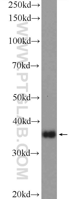 Western Blot (WB) analysis of HL-60 cells using HOXD13 Polyclonal antibody (23520-1-AP)