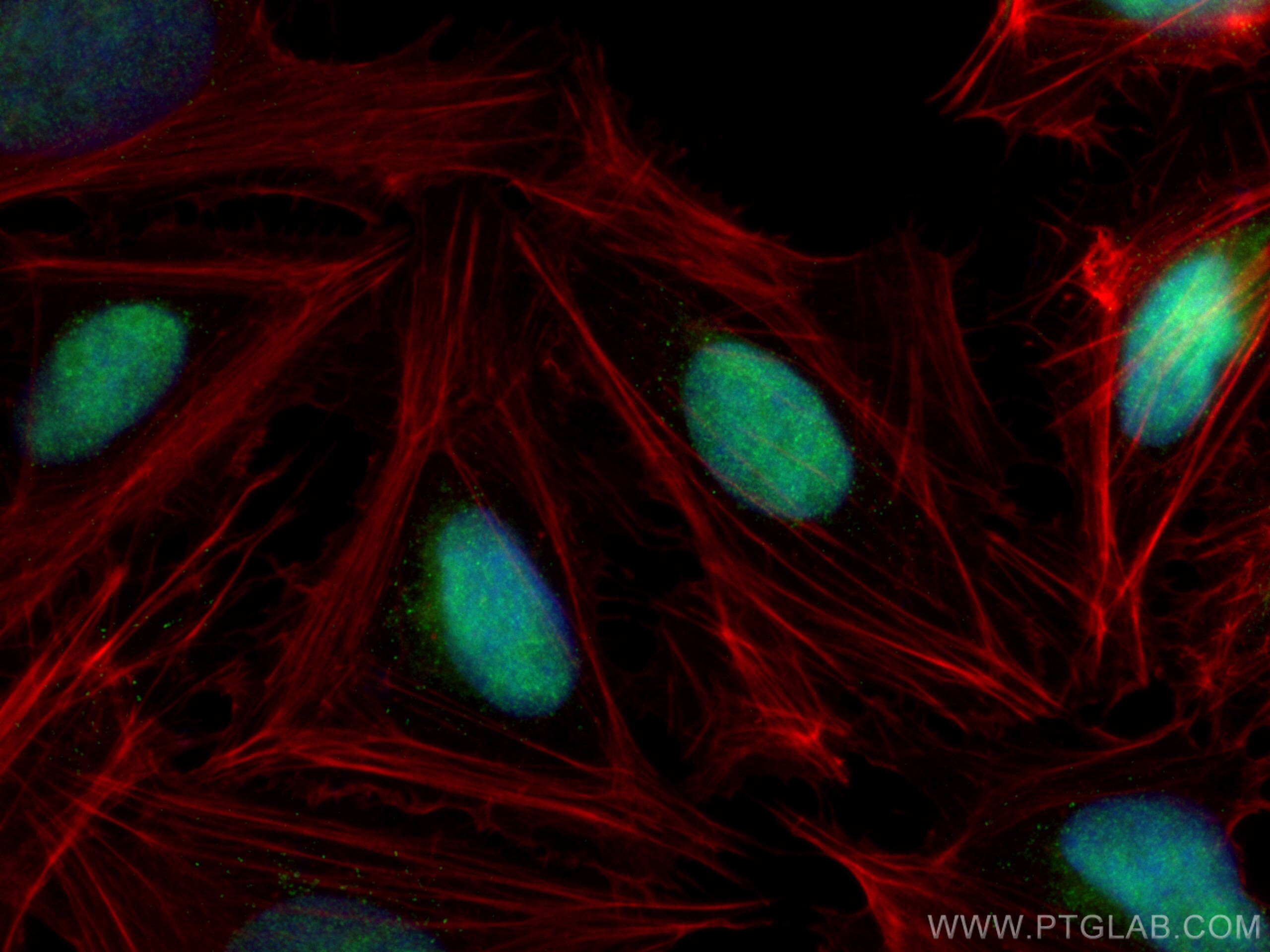 Immunofluorescence (IF) / fluorescent staining of U2OS cells using HOXD3 Polyclonal antibody (10496-1-AP)