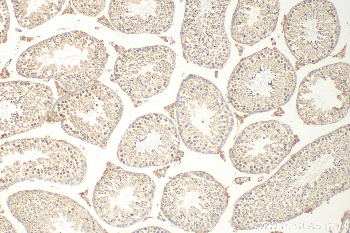 Immunohistochemistry (IHC) staining of mouse testis tissue using HOXD3 Polyclonal antibody (10496-1-AP)