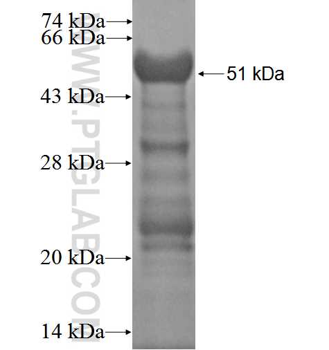 HOXD3 fusion protein Ag0768 SDS-PAGE