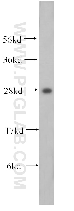 Western Blot (WB) analysis of A549 cells using HOXD4 Polyclonal antibody (17780-1-AP)
