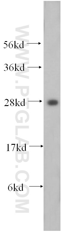 WB analysis of A549 using 17780-1-AP