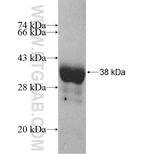 HOXD4 fusion protein Ag11134 SDS-PAGE