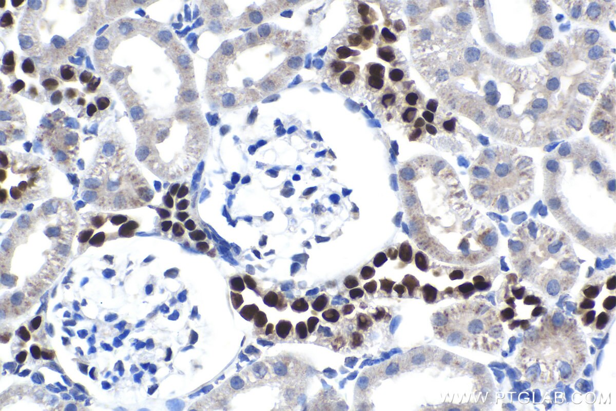 IHC staining of rat kidney using 18588-1-AP Immunohistochemistry (IHC) staining of rat kidney tissue using HOXD8 Polyclonal antibody (18588-1-AP)