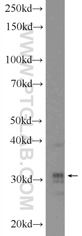 Western Blot (WB) analysis of A375 cells using HOXD8 Polyclonal antibody (18588-1-AP)