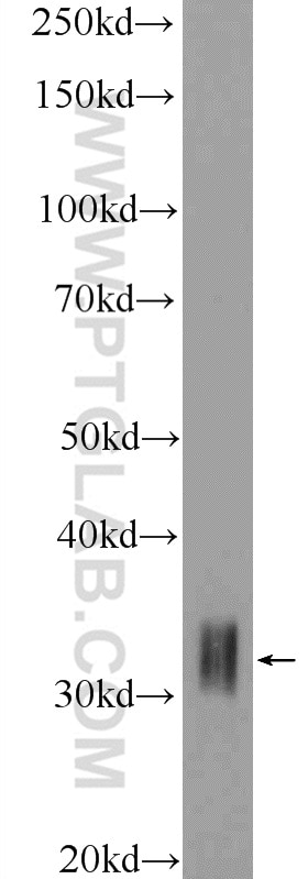 Western Blot (WB) analysis of HeLa cells using HOXD8 Polyclonal antibody (18588-1-AP)