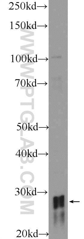 Western Blot (WB) analysis of HEK-293 cells using HOXD8 Polyclonal antibody (18588-1-AP)