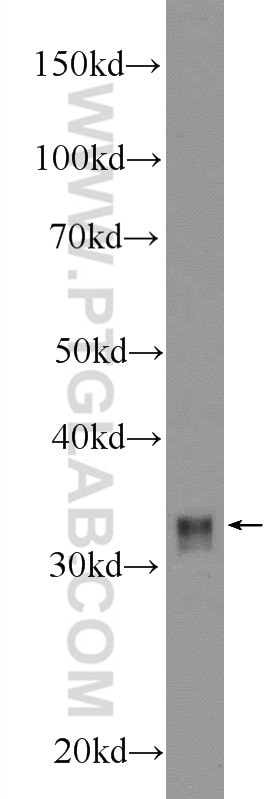 Western Blot (WB) analysis of A375 cells using HOXD8 Polyclonal antibody (18588-1-AP)