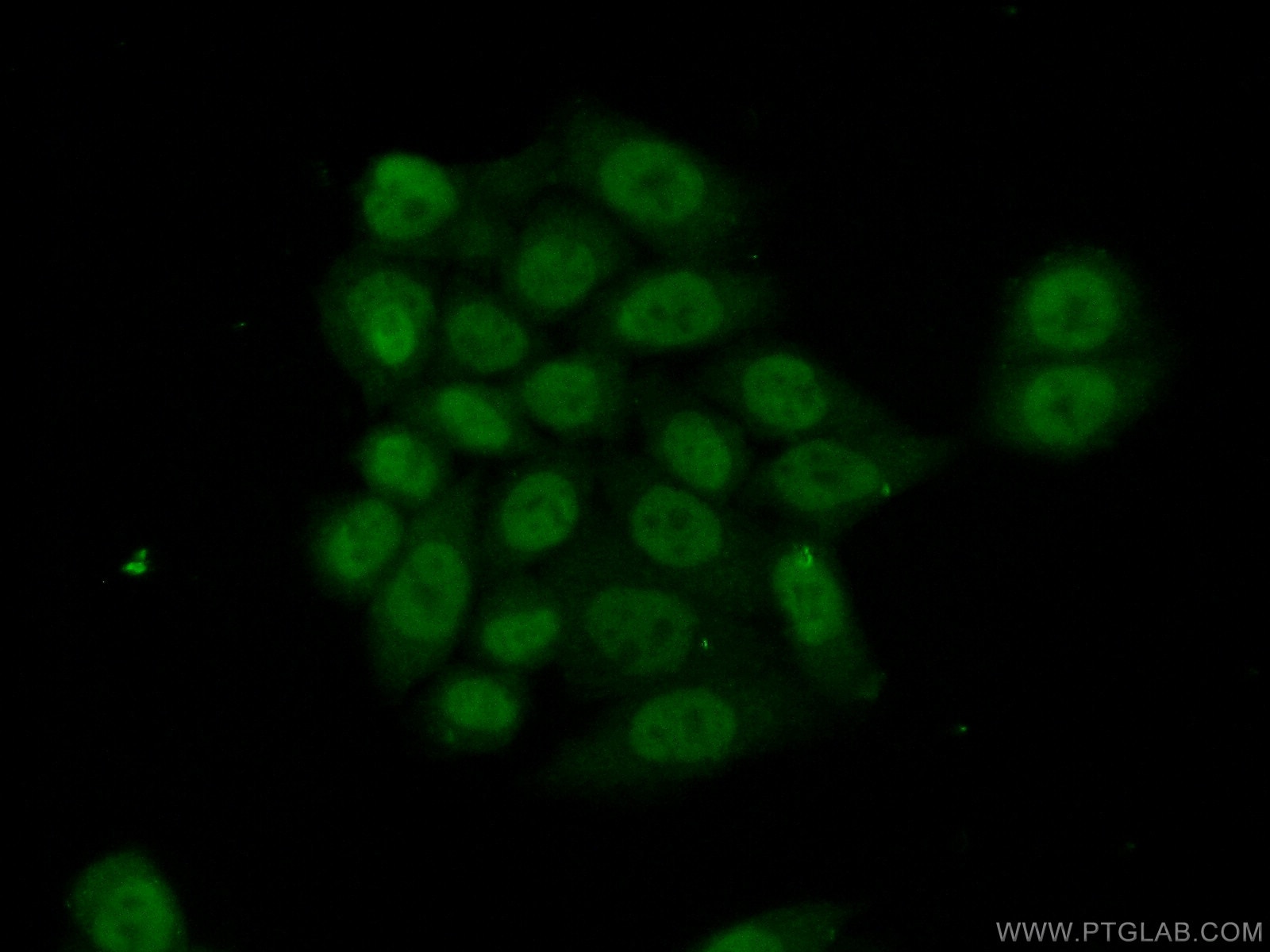 Immunofluorescence (IF) / fluorescent staining of HeLa cells using HOXD9 Polyclonal antibody (20560-1-AP)