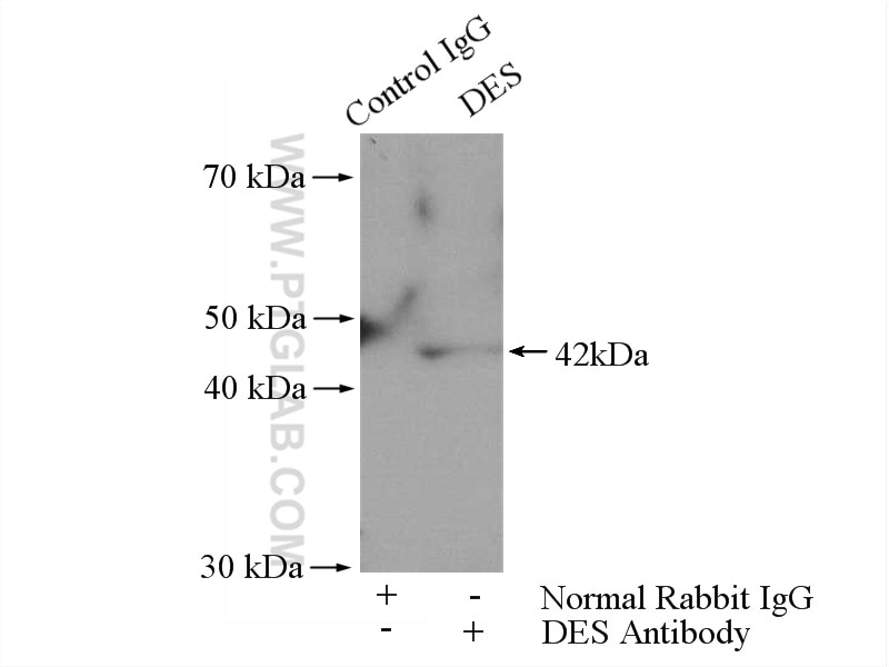 IP experiment of HepG2 using 16665-1-AP