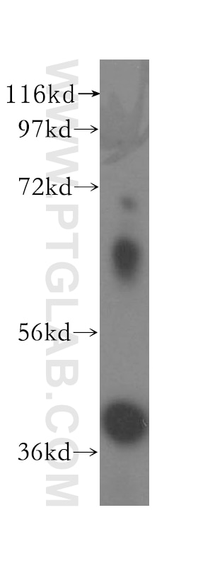 Western Blot (WB) analysis of human liver tissue using Haptoglobin Polyclonal antibody (16665-1-AP)