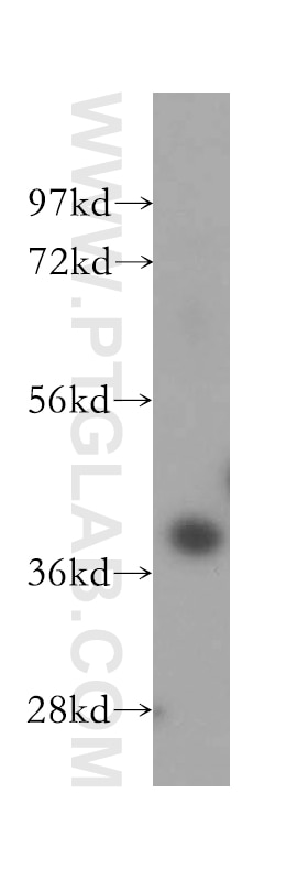 Western Blot (WB) analysis of HEK-293 cells using Haptoglobin Polyclonal antibody (16665-1-AP)
