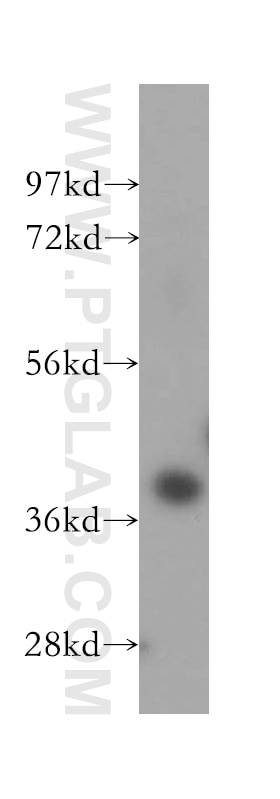 WB analysis of HEK-293 using 16665-1-AP