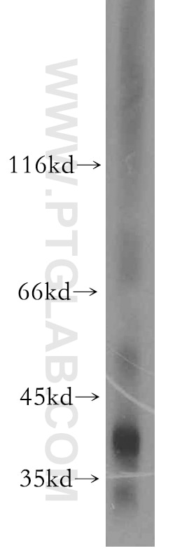 Western Blot (WB) analysis of human liver tissue using Haptoglobin Polyclonal antibody (16665-1-AP)