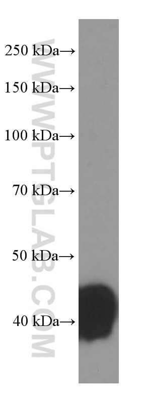 Haptoglobin