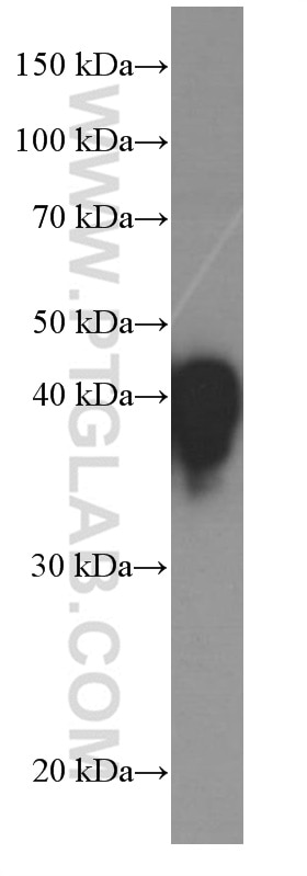Western Blot (WB) analysis of human plasma using Haptoglobin Monoclonal antibody (66229-1-Ig)