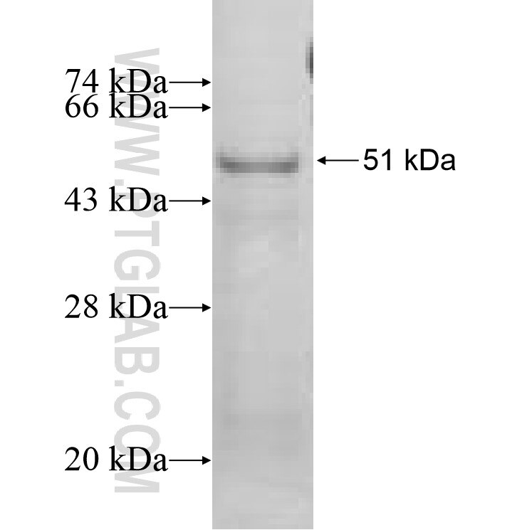 HP fusion protein Ag10143 SDS-PAGE