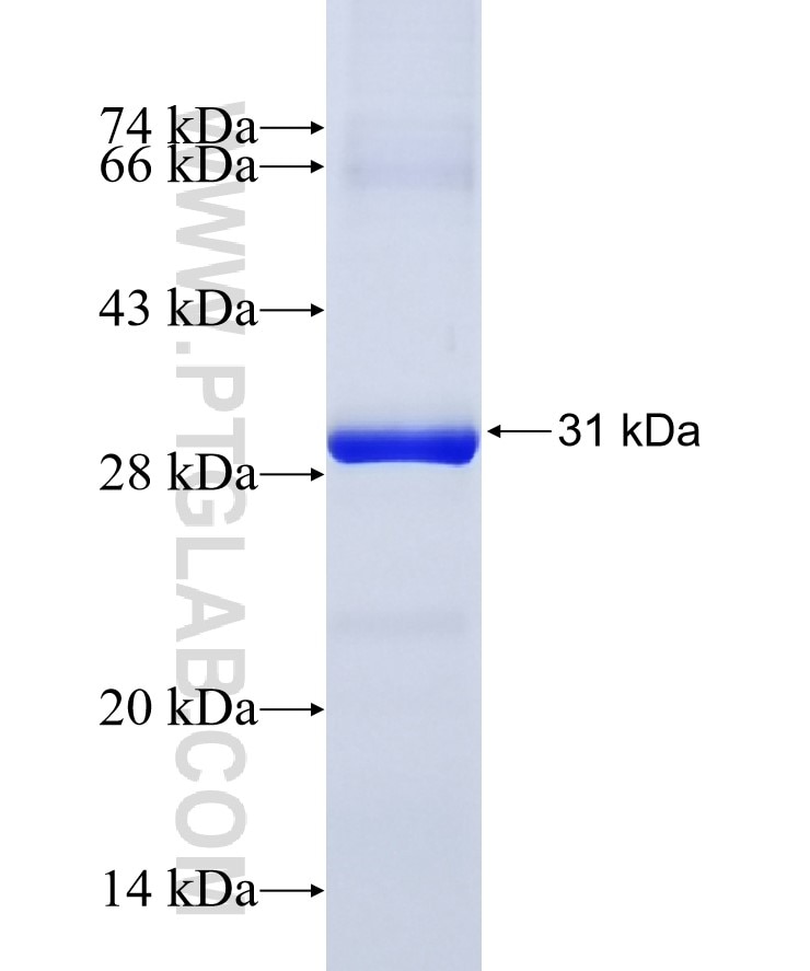 HP fusion protein Ag9927 SDS-PAGE